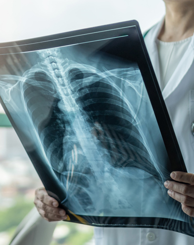 xray